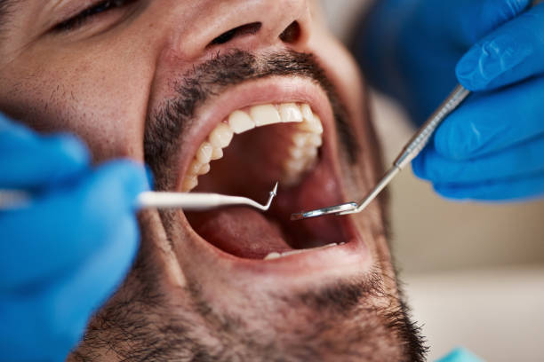 Best Emergency Dentist for Knocked-Out Tooth in Noyack, NY